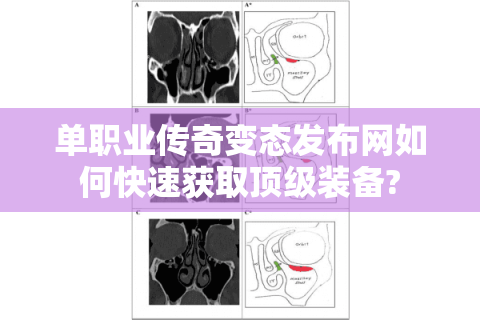 单职业传奇变态发布网如何快速获取顶级装备?