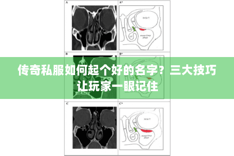 传奇私服如何起个好的名字？三大技巧让玩家一眼记住