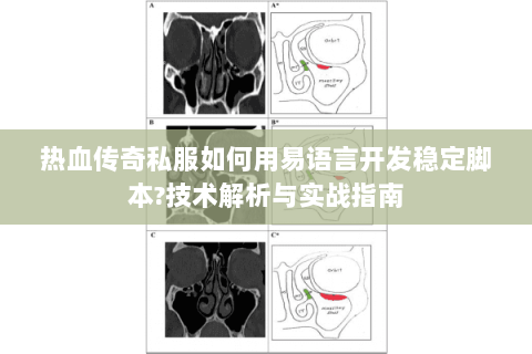 热血传奇私服如何用易语言开发稳定脚本?技术解析与实战指南