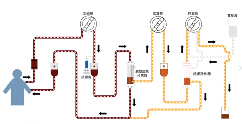 沙丘觉醒:揭秘血液净化器高效使用攻略 沙丘觉醒:揭秘血液净化器高效使用攻略